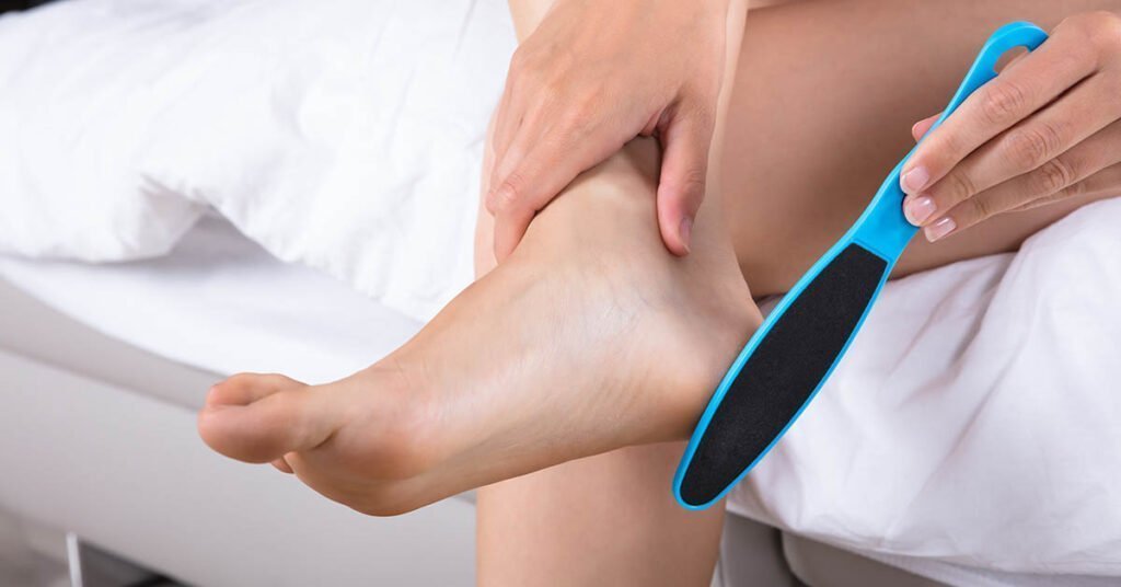 Hornhaut entfernen mit Hornhautfeile - Schritte für die Behandlung zu Hause